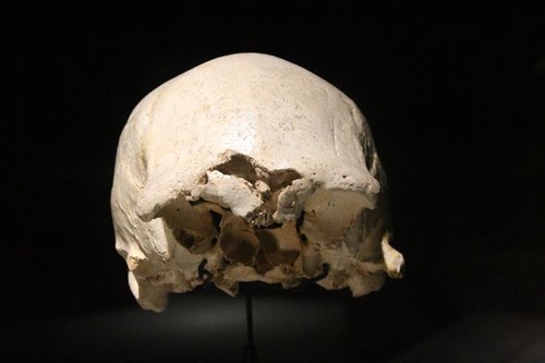 Cráneo 4